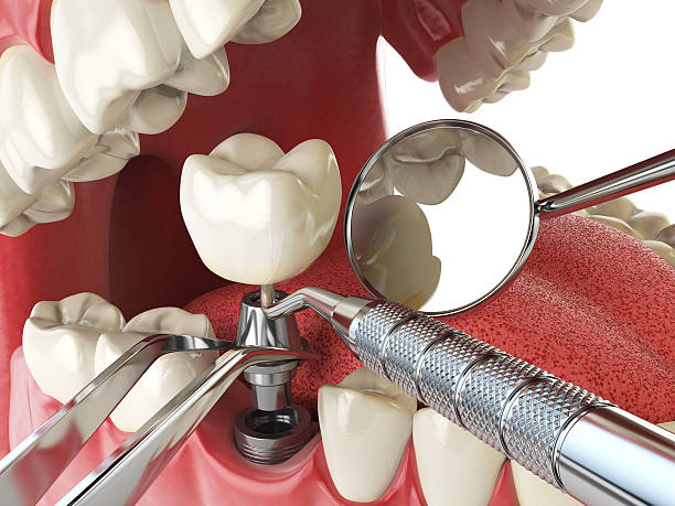 Best Emergency Root Canal Therapy in Virginia Gardens, FL